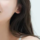 ニキビ